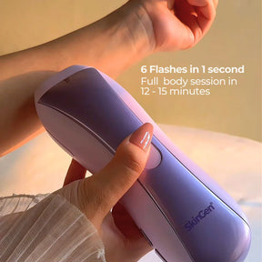 Skingen FastFlash Smart IPL 2.0