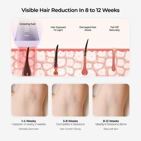 Skingen FastFlash Smart IPL 2.0